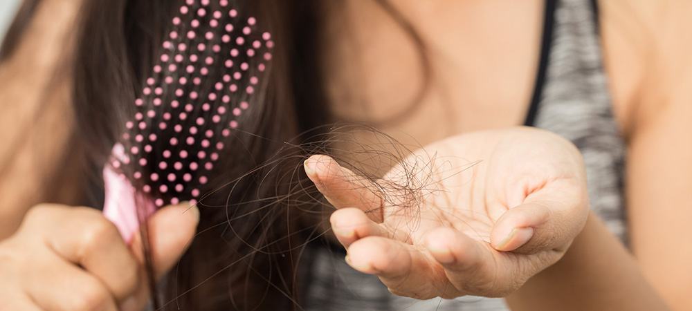 女性の薄毛