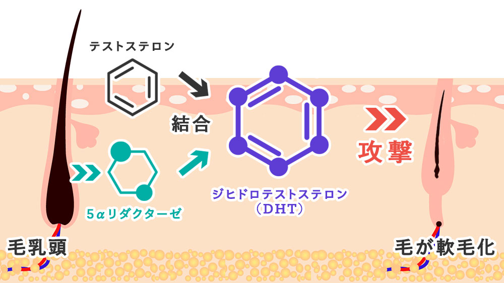 １本の毛根