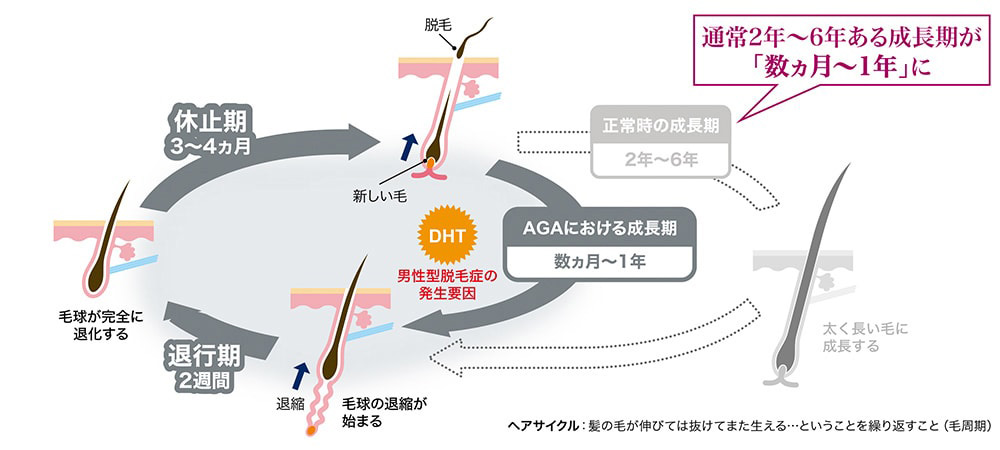 ヘアサイクル